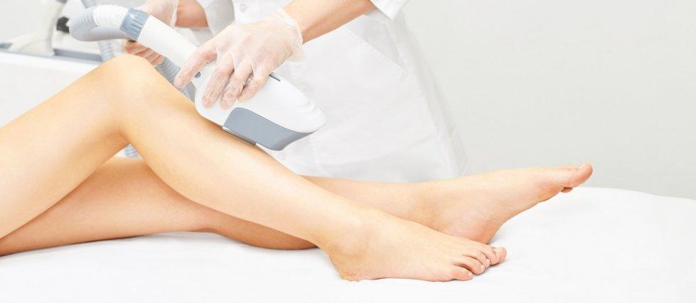 Depilación laser 